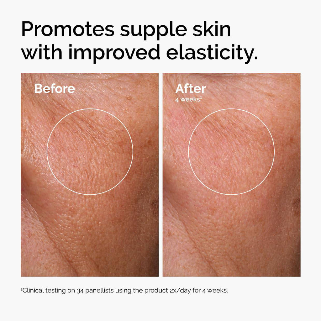 SlimBag The Ordinary Mini Icons Set with travel-size glycolic acid toner, niacinamide serum, hyaluronic acid, and reusable rounds