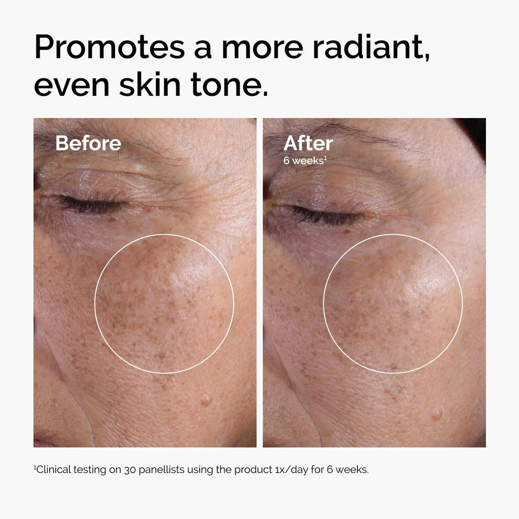 SlimBag Glycolic Acid 7% exfoliating toner bottle with clear liquid, designed for brightening and smoothing skin tone.